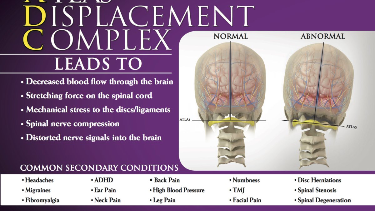 Upper Cervical Chiropractic