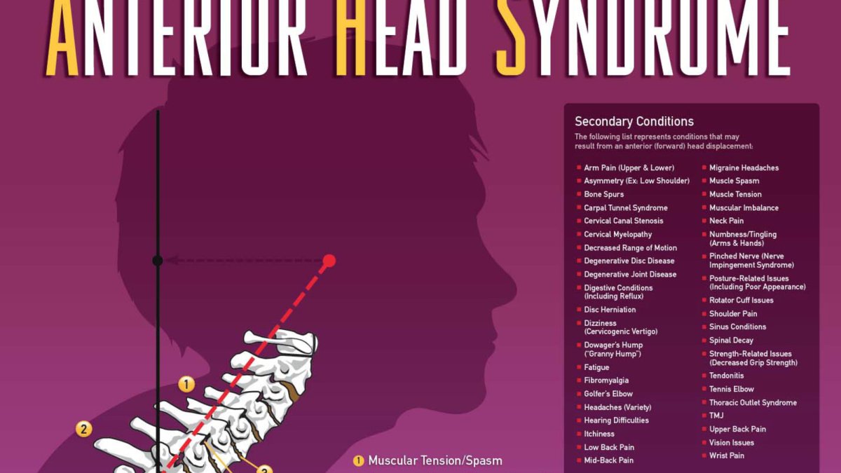 Anterior Head Syndrome