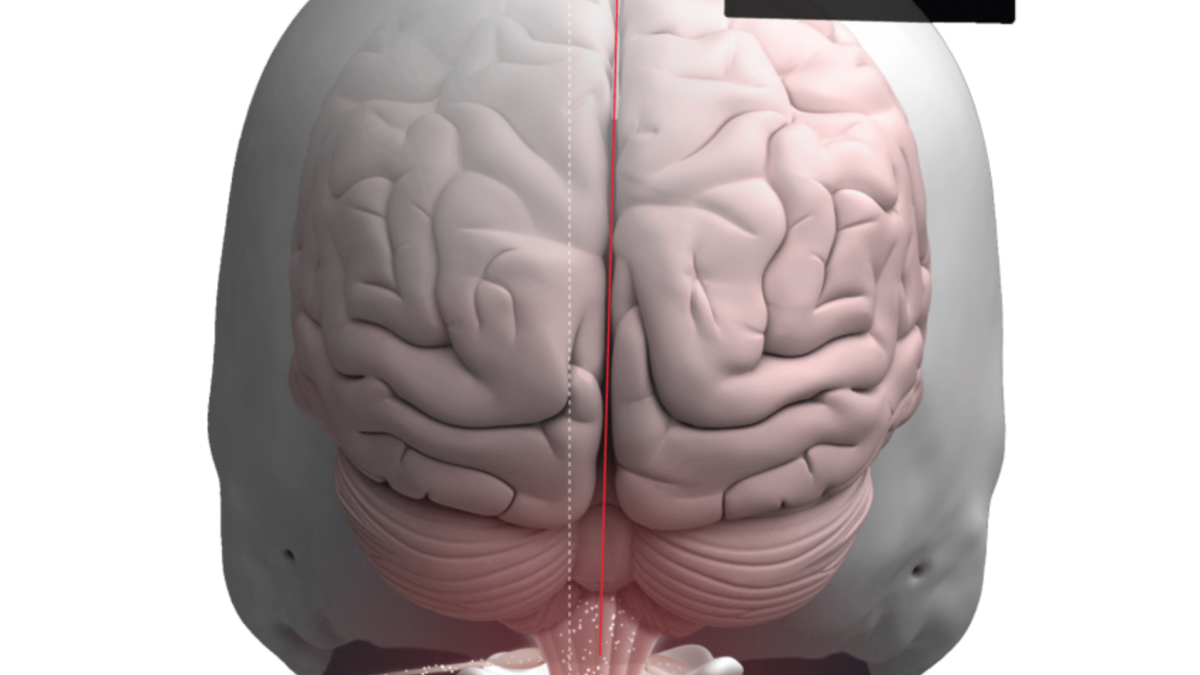 Structural Shift - Atlas Displacement Complex